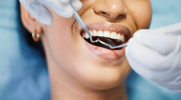 Best Knocked-Out Tooth Emergency  in Martindale, TX