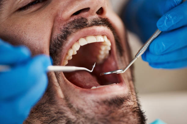 Best Broken Tooth Emergency  in Martindale, TX